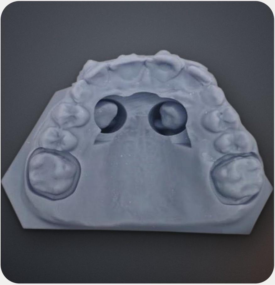 Modello dentale tridimensionale mostrato nella brochure Line Up Italia
